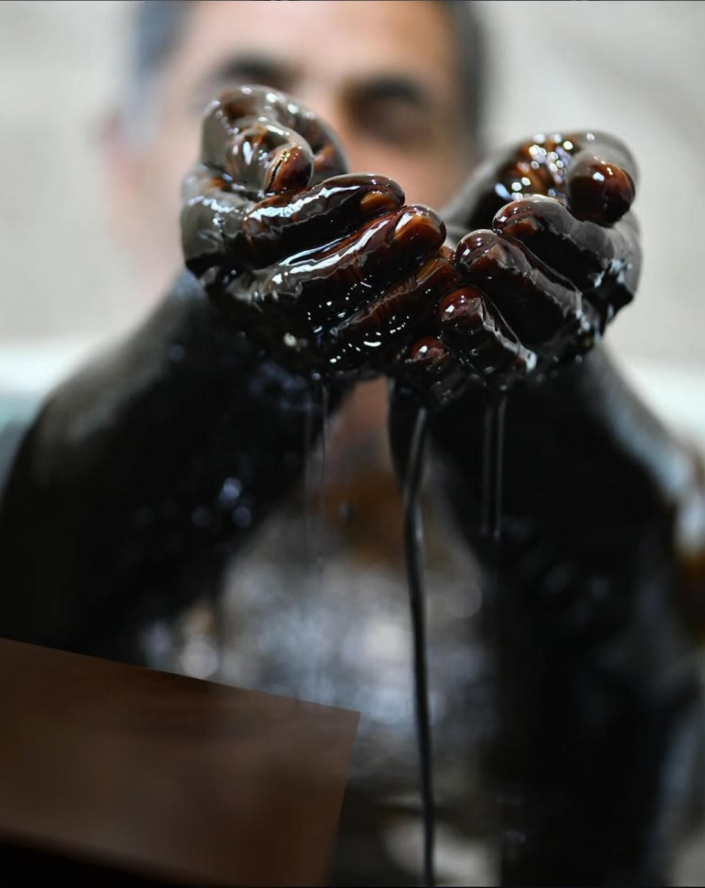 Naftalan oil bath — the core treatment around which the programme is built.